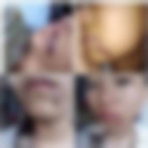 7、石家庄合美整形医院价格表/收费区间参考