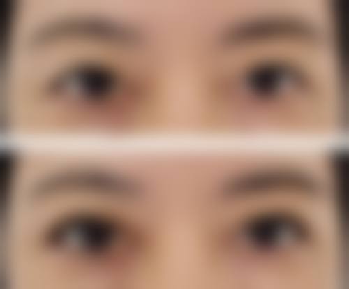 五、柠檬片敷眼去眼袋成效如何