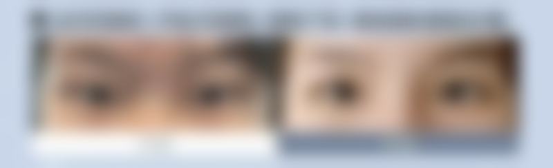 四、柠檬片敷眼去眼袋有哪些注意事项