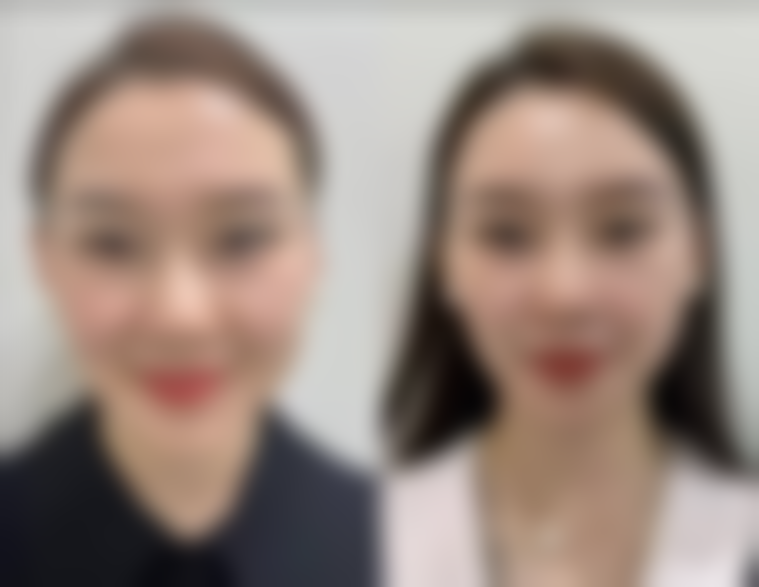 七、阴道紧缩术的风险与后遗症