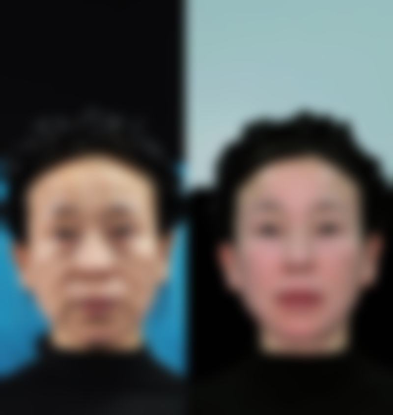 韓國4月31日鼻修復診所揀選要點:香港/澳門姊妹避坑指南