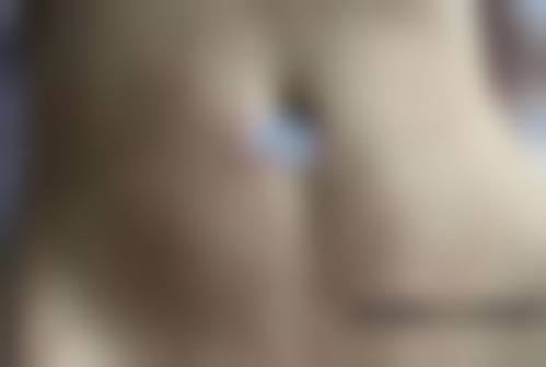 2、【隆乳术】核心技术优势