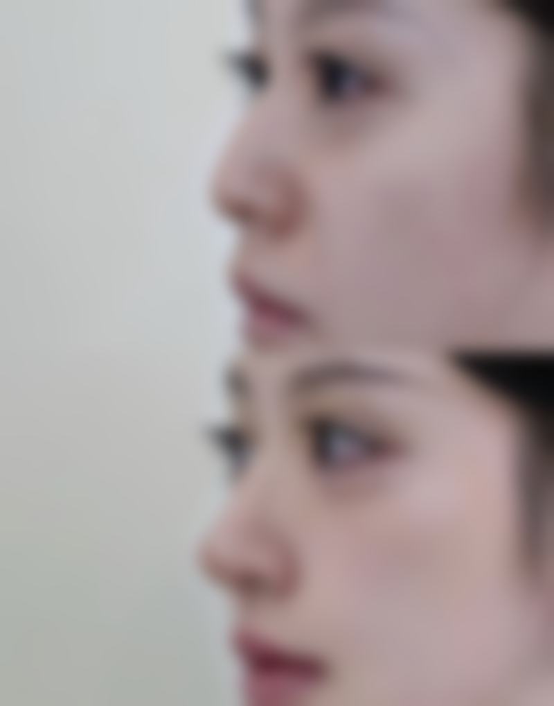 台州百佳医疗美容医院口碑如何