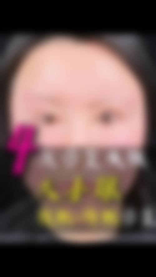 三、不同眼部条件适合的手术方式——哪种双眼皮手术成效好