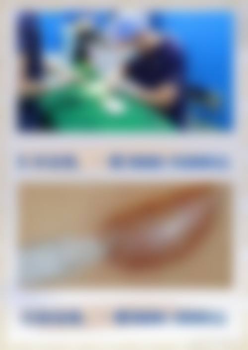 三、疤痕疙瘩增大的影响因素