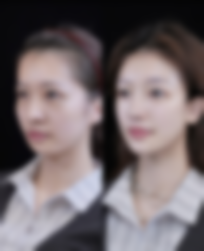 {韓國波輪美整形醫院價格表2026中韓報價大公開！手術費用/項目收費一文睇清