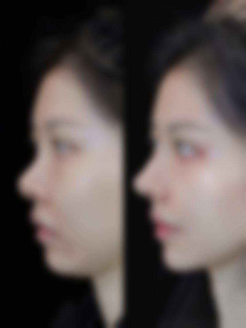 八、患者真实就诊体验 / 口碑实例反馈一例