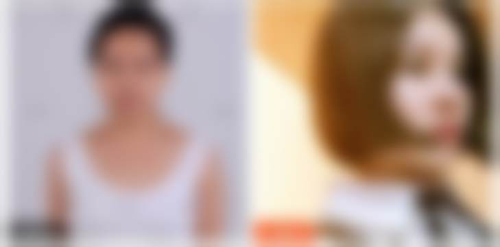 黑龙江瑞丽整形双眼皮医生哪个好?除了马莹莹,这些骨干医生也值得选