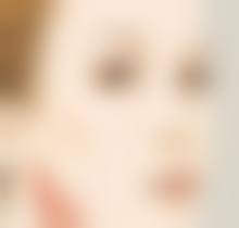 香港做疤痕修復:點樣揀啱診所?(附韓國安成烈對比)