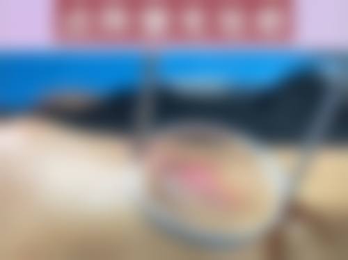 六、去除脸上黑疤痕价格一般多少