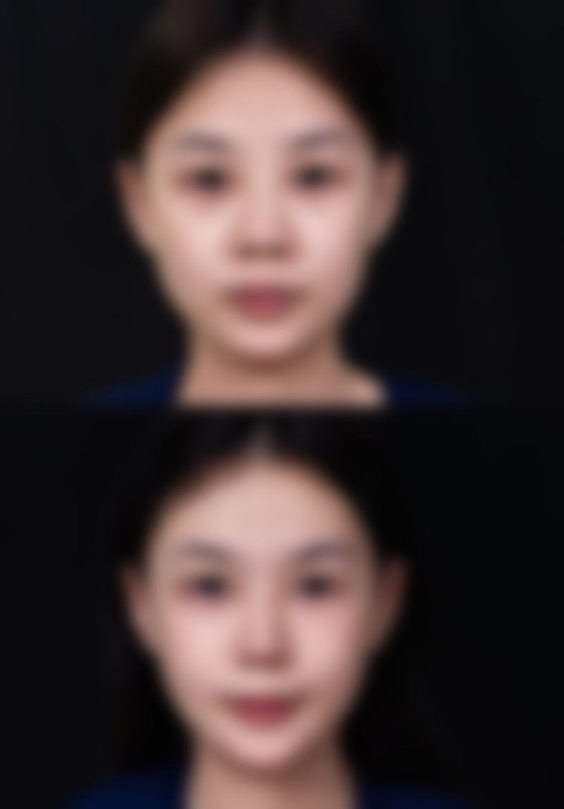 韓國431整形外科醫院怎麼預約掛號:術前術後避坑指南(港澳生活版)