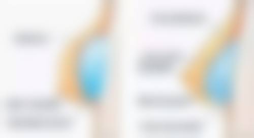 1、口碑与评价参考