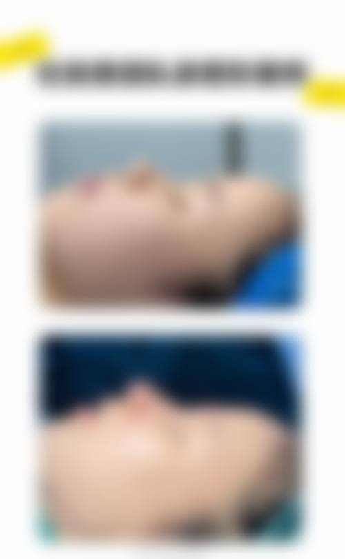 九、昆明悦容雅塑医疗美容门诊部口碑与评价