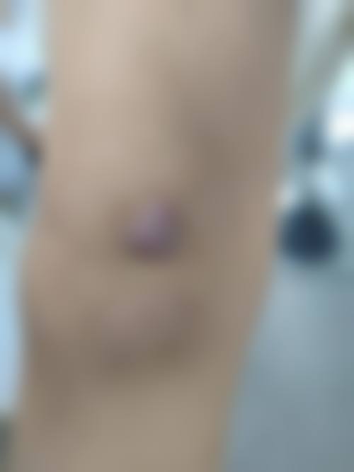 十一、东莞市中医院整形美容科真人口碑实例评价一览