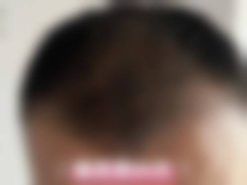 三、曼谷LaGrace整形诊所开展项目