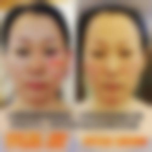 七、武汉彼家美创医疗美容诊所(江岸院)价格表/收费标准一览