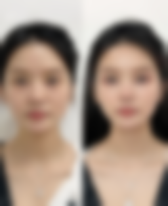 8、解放军第411医院价格表/收费区间参考