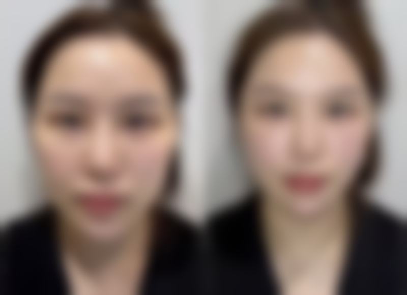 韓國baid皮膚科怎麼預約掛號 3大攻略:唔使識韓文都啱用