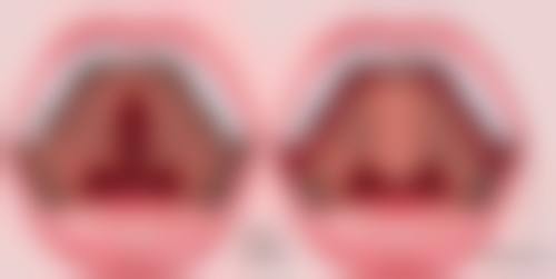 韓國普羅菲爾Profile整形醫院價格表2026中韓報價:邊度做更抵?中韓港澳全對比