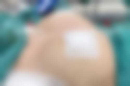 二、张新成医生擅长项目：