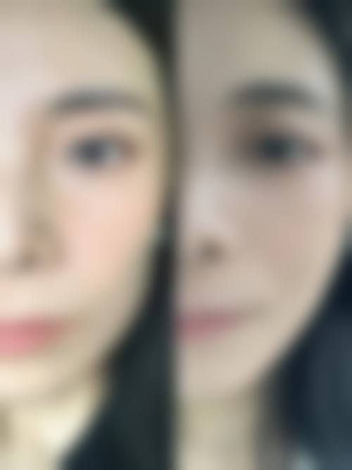 三、王鹏医生技术水平特点