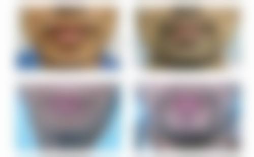 三、王麒麟擅长项目及优势
