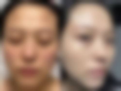 十、常德柳叶湖蔻妍医疗美容诊所真人口碑实例评价一览