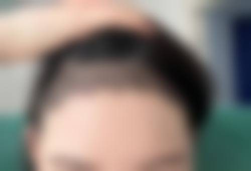 十五、龙港卢飞宇整形医院患者常见问答