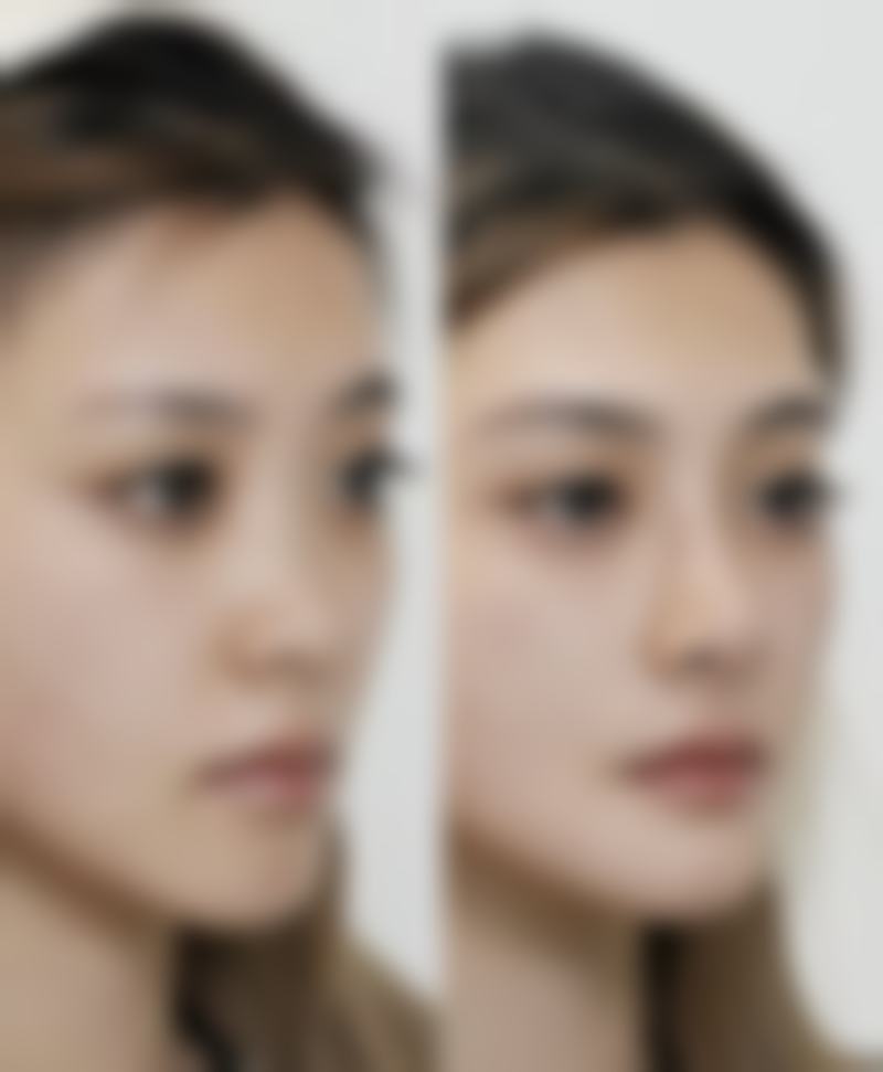 王恒医生手术成效展现