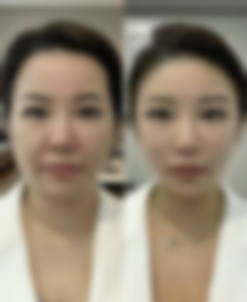 四、龙港卢飞宇整形医院正规靠谱吗