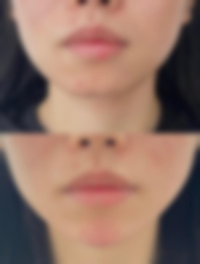 三、擅长项目