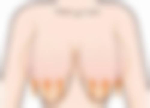 {韓國鼻修復幾時做最好？2026年3月淡季最啱！GNG/HERA中文服務自然修復