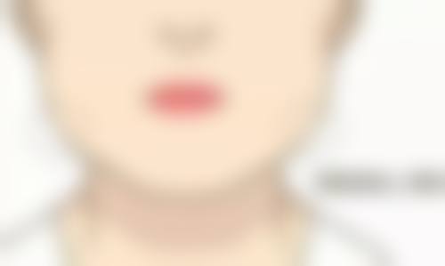 韓國BLS皮膚科醫美項目真相:港澳姊妹常見Q&A