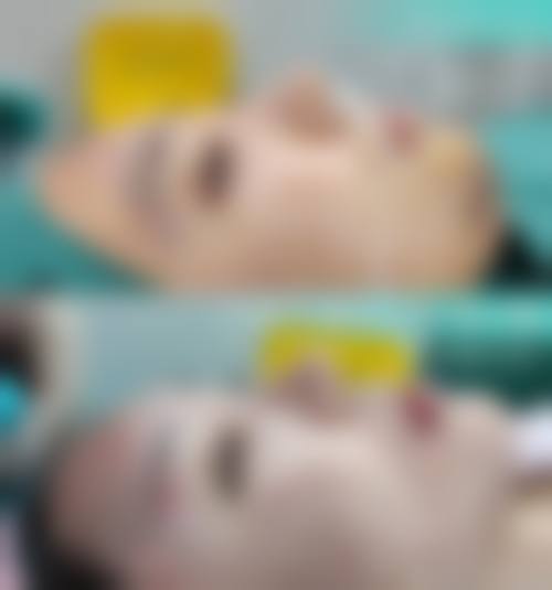 三、北京爱丽友医疗美容诊所开展项目