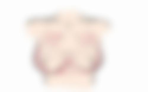 三、自体脂肪隆胸修复期有哪些注意事项？