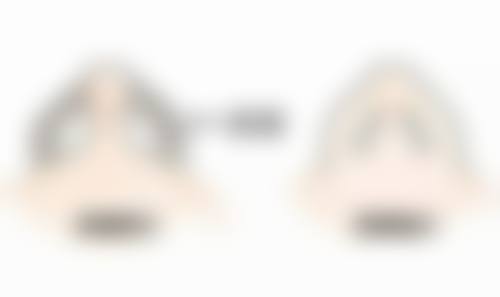 十五、TCB 鹿児島患者常见问答