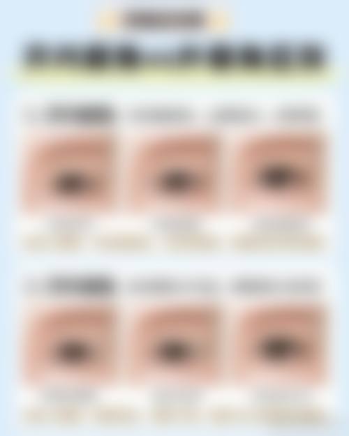 六、去眼袋价格一般多少