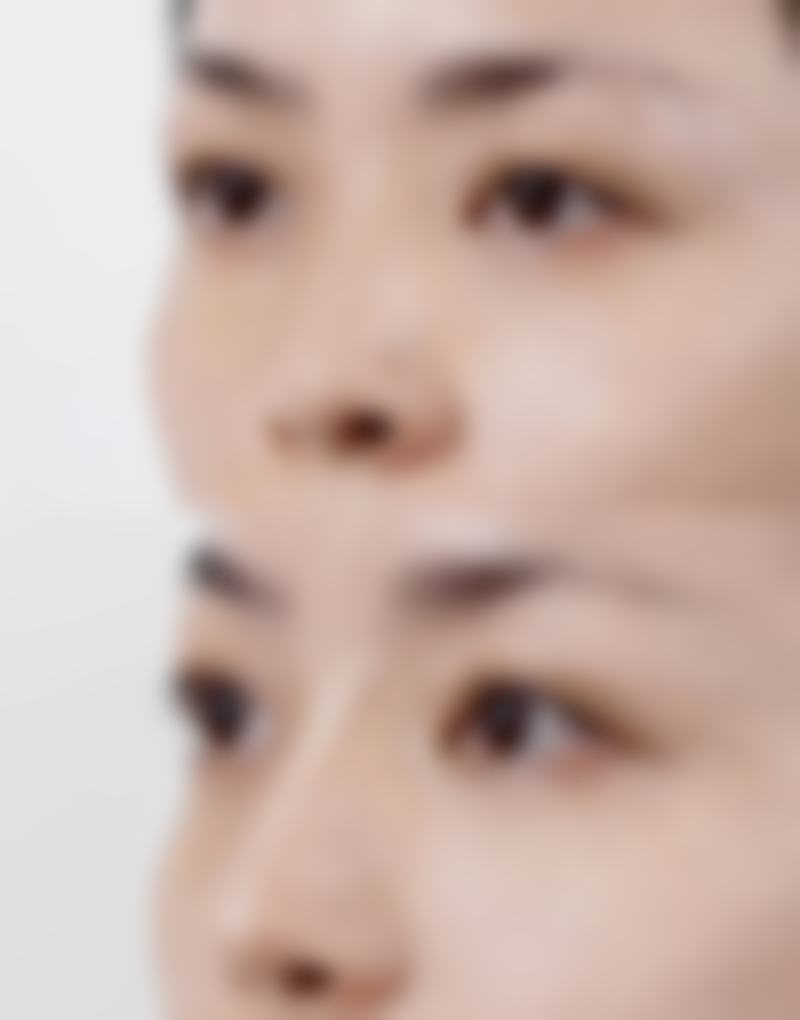 五、泰国清迈Lannawadee兰纳瓦德整形外科重点特色诊疗项目