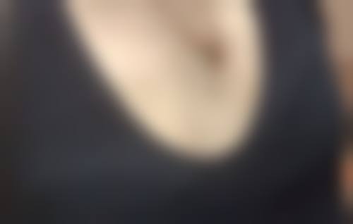 拓展延伸:後腦勺手術常見問題解答