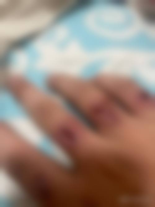 九、田宇医生常见就诊关注点说明