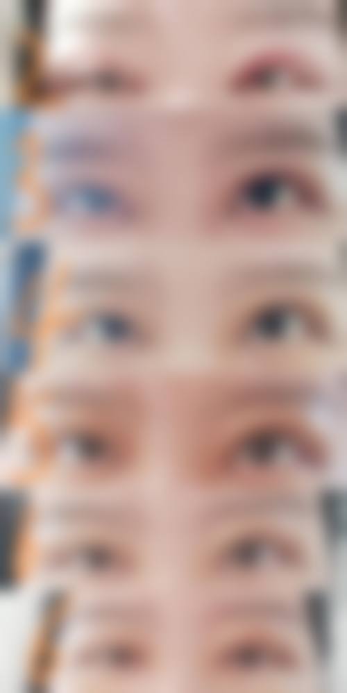 韓國MINE雙眼皮自然嗎:適合邊類人群?