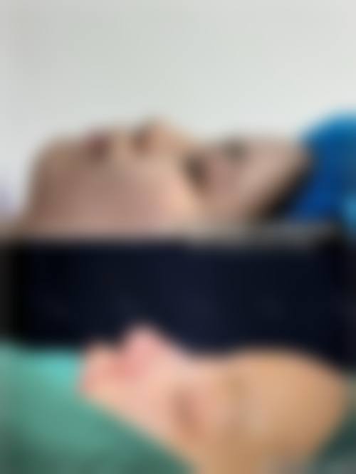 十、黄蔹茹医生擅长项目科普:注射除皱介绍