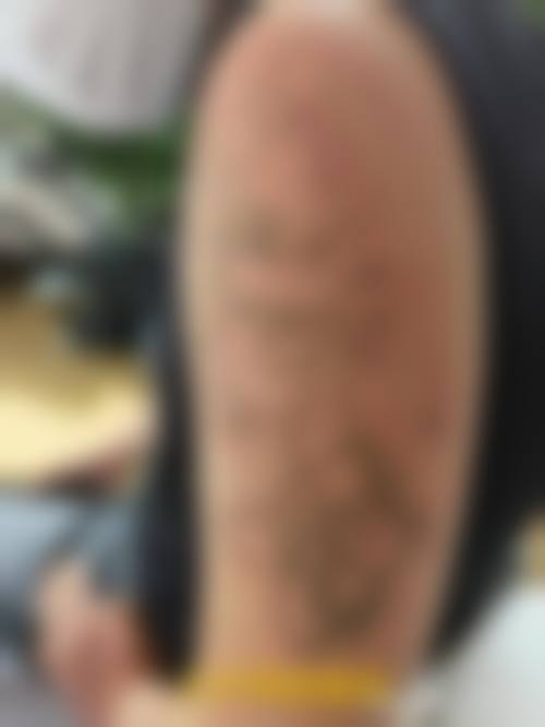 九、厦门思明瑞麒麟诊所基础美白水光24小时在线预约