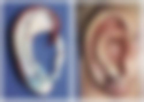 6、西安市红会医院足踝外科(拇外翻手术)口碑好评反馈