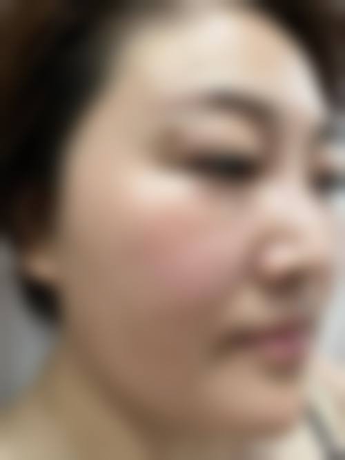 上海卓栎丽格皮肤科门诊部患者常见问题解答（精选 ）