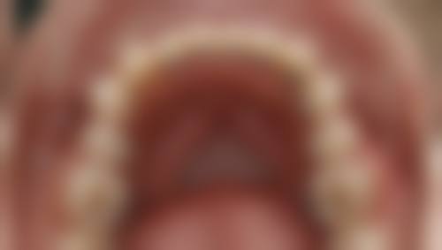 九、常熟玉蕙口腔医院口碑好不好？患者诊室评价：