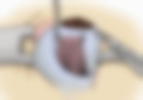 襄阳爱尔眼科医院正规可靠吗？