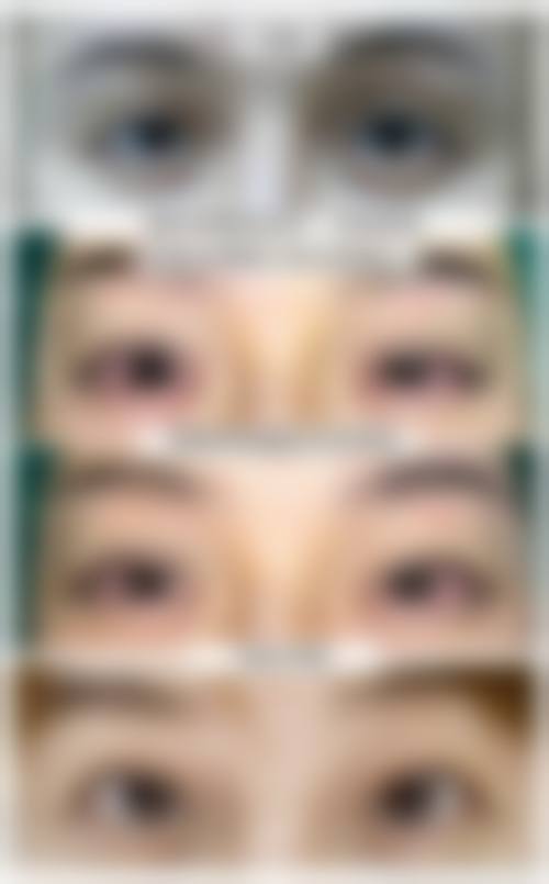 三、济宁柏羽嘉仁整形医院开展项目及特色技术
