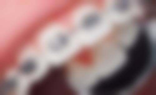 五、东莞雷四 医生坐诊哪个医院？