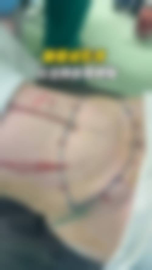 五、询问翟爽医生领1V1方案